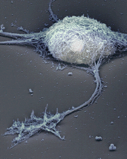 diamidinophenylindolee:  Single neuron under the electron microscope.