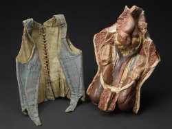 Plaster model showing internal organs displaced due to tight