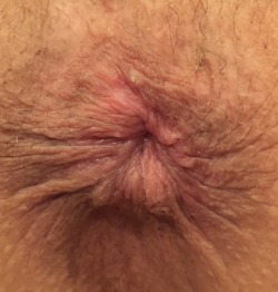 curiouscpl4dp:  You like my tight little butt hole?