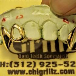 chigrillz-goldteeth:  😬 #Custom #Grillz #Openface #k9 Medium