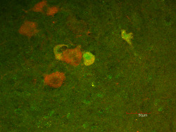 neurosciencestuff:  (Image caption: The presence of p45 (green