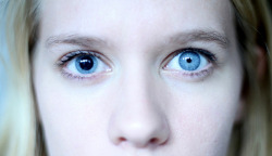 cynicallys:   Anisocoria: inequality in the size of the pupils