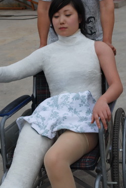 Female patient in body cast, legcast, armcast and wheelchair