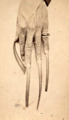 Ongles, vers 1880.