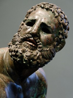 caravaggista:    Seated Boxer (300–200 BC). Bronze and copper,
