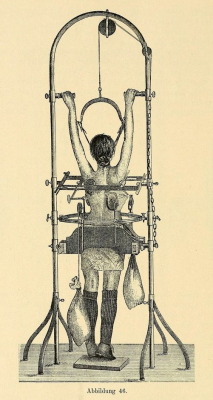 orchid-room:  nemfrog:   Apparatus for the treatment of scoliosis. Zur