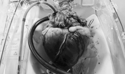 nothorrorcore:  My heart beats for you. It’s all yours. 
