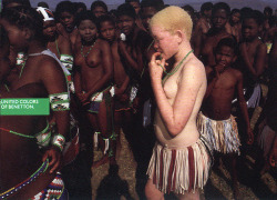 tribalfav:  lafemmenue:   Albino Girl for United Colors of Benetton