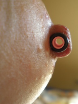 piercingmeta:  satanicslave:  Nipple modification. Click pic