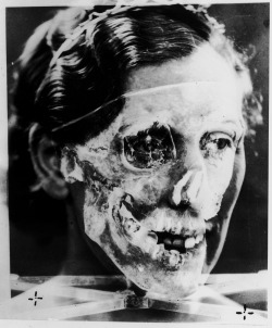 Ms Ruxton & her skull University of Glasgow, 1935
