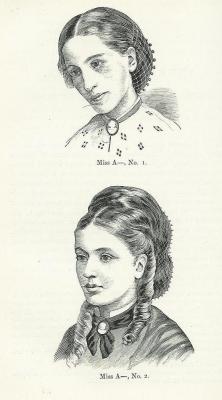 The case of Miss A, pictured in 1866 (at 17), and in 1870 (at