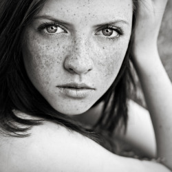 (via fuckyeahfreckles, whyhellotherematey) I can’t resist