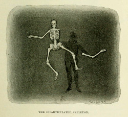 sugarmeows:  “The Disarticulated Skeleton” From Magic: Stage