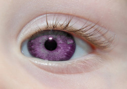   Alexandria’s Genesis, a.k.a violet eyes (a genetic mutation).