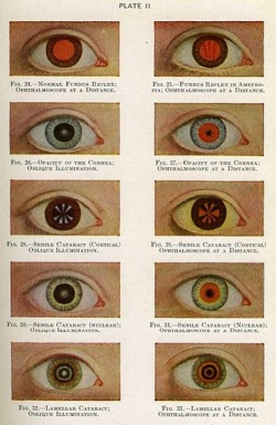 vintague-blog:  Manual of the Diseases of the Eye for Students