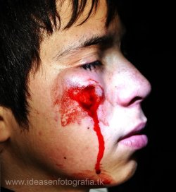sebastianhumphrey:   Niño de 13 años impactado en el rostro