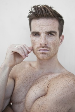 vandalcetti:  This guy is… idk, kinda cute to me. the freckles. 