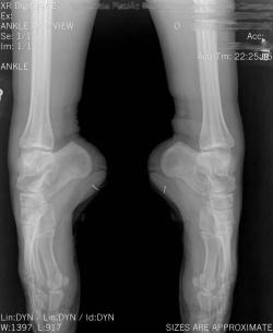 ashleeta:  An X-ray of a Ballerina En Pointe 