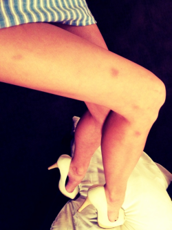 Bruised stems.