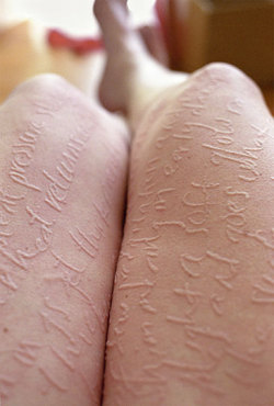 deaf-mutes:  “I have dermatographia, a condition in which one’s