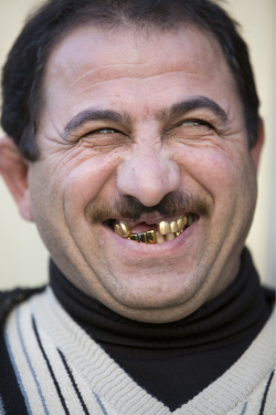 Golden Teeth After the collapse of the Soviet Union, the citizens