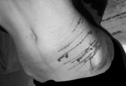 "I'm fine."