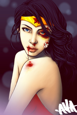 nrrrdcakkke:  “You Should See the Other Guy” By Alivia -