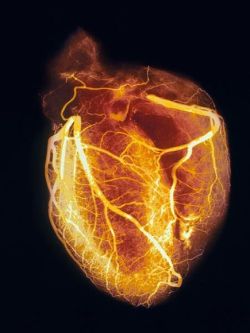 expose-the-light:  Angiogram of Healthy Heart Photograph by SPL/Photo