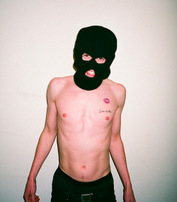 acne:  purple kiss by i am lucky, on Flickr