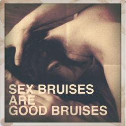 No they’re not. They’re GREAT bruises. Only like