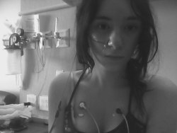  eringeremick: This is Haylee. I met her online recently and was given permission to share her story. Shes 16 years old and has been suffering with Anorexia Nervosa (binge purge subtype) for 10 years now. She hasÂ permanentÂ heart problems, shes has 2