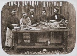 Dissection d'un corps humain vers 1865 en France.