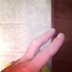 Mom thinks I broke my finger.. When I try to  stretch it out