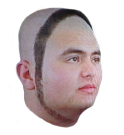 scrotumcoat