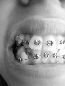 buscatusalida:  Me aburrí de ver fotos de dientes lindos con