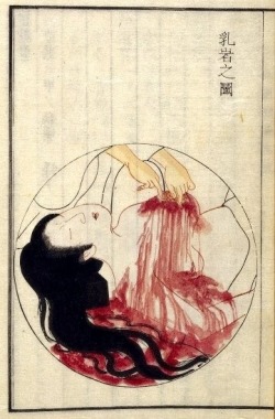 necr-ophelia:  Kamata Keishu, Surgery for Breast Cancer, 1851.