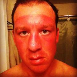 Freeland doesn’t tan well…done.