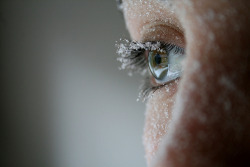 crystallized-kitty:  You have some frost on your eye 