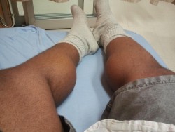 Meanwhile in the hospital…  Are my calves sexy are what!?
