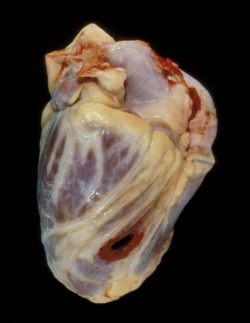  Hearts, Angela Strassheim 1. Shot in the Heart. 2. Cancer Heart.