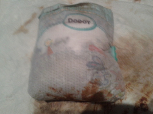 My girlfiendÂ´s diaper when she waked up she is with diarrea