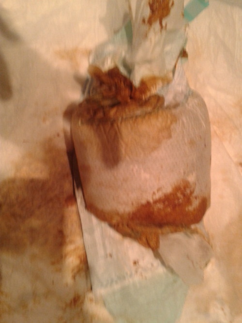 My girlfiendÂ´s diaper when she waked up she is with diarrea