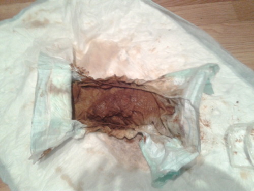 My girlfiendÂ´s diaper when she waked up she is with diarrea