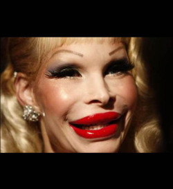 lulz-time:  Plastic surgery gone horribly wrong! Fyi, these pics