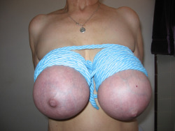 blueveined:  The veins show up nicely on her well bound tits, pic 1 of 2.  Speaking of veins.