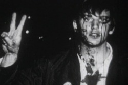  A sixties kid flashes the peace sign after being beaten by riot