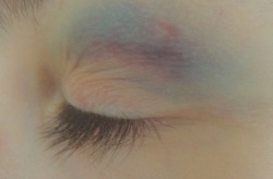 pizzha:  is this eyeshadow or is this a bruise im kinda dumb