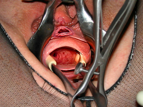 sluttcunt:  Pix like this make me wonder just how much you have to pay a slut to let you actually open her cunt wide enough, to then ACTUALLY spread her cervix open, WIDE enough to actually see one of the entrances to an ovary? Never thought Iâ€™d be