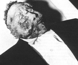 ramirezbundydahmer:  1955 photograph of the mutilated body of