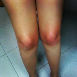 Olha que belezura #Gabi’s #knees